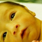 Chứng vàng da ở trẻ sơ sinh