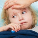 Cách nào chữa bệnh sởi cho trẻ em hiệu quả?